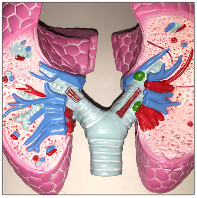 Plastic COPD-de Organenmodel Diepgewortelde Lerende 19x13x17cm van het Long Menselijke Lichaam